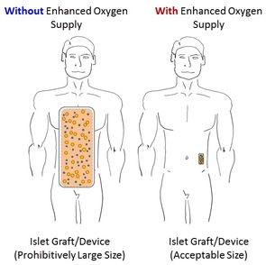 Papas is studying how a small oxygen generator might help significantly reduce size requirements for an implantable device containing insulin-producing islet cells for diabetic patients in need. (Image adapted from an illustration by Tom Suszynski) Papas is studying how a small oxygen generator might help significantly reduce size requirements for an implantable device containing insulin-producing islet cells for diabetic patients in need.